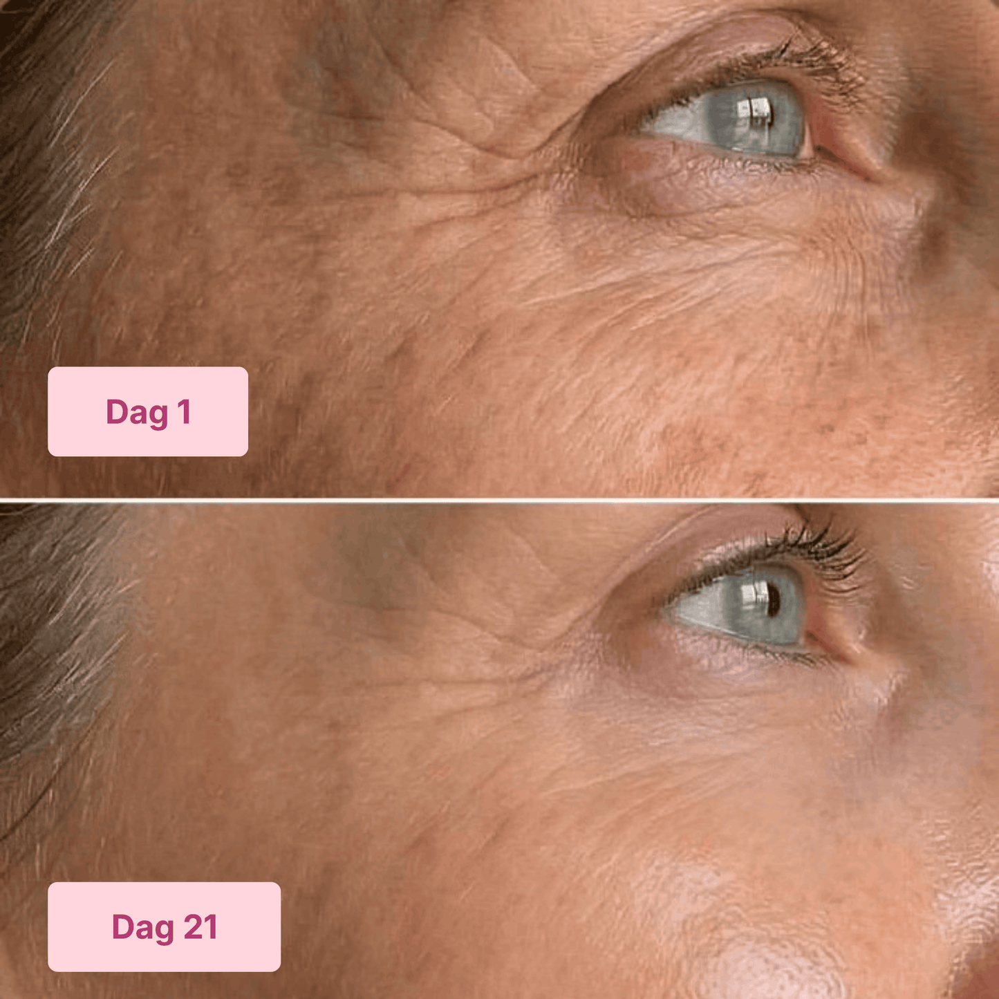 5-Step Anti Aging Kit RITĂEL