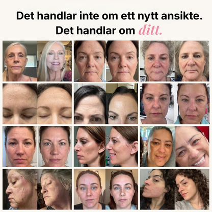 before and after
